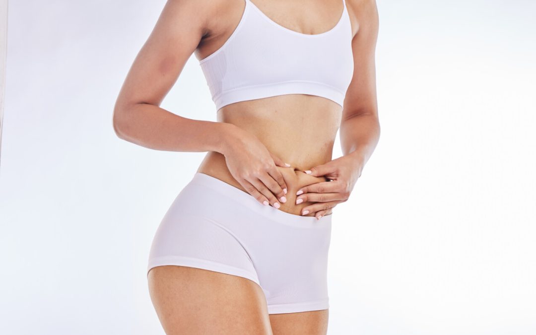 Tummy Tuck vs. Liposuction: What’s the difference?