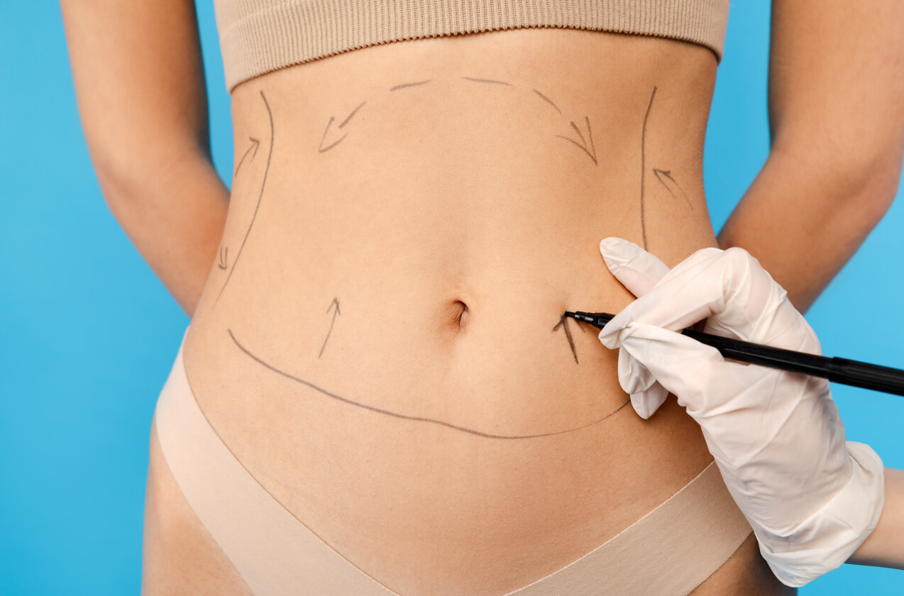 Liposuction Austin Tx