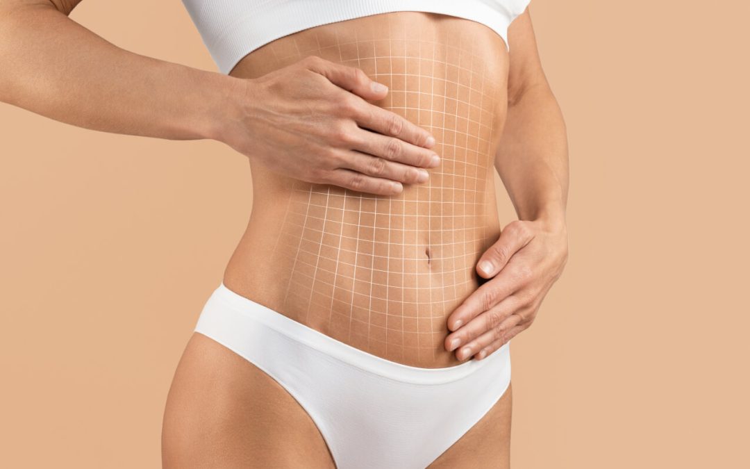 Top Tips for a Smooth Recovery After Tummy Tuck Surgery